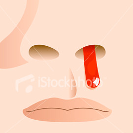Nose bleeding alias mimisan